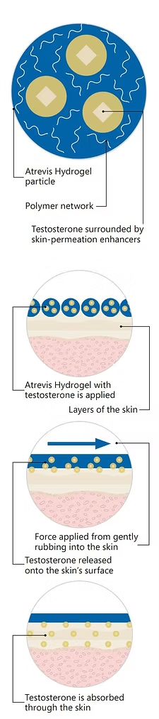 With Testosterone, It's All about that Base